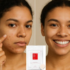 COSRX Acne Pimple Master Patch (24 patches)
